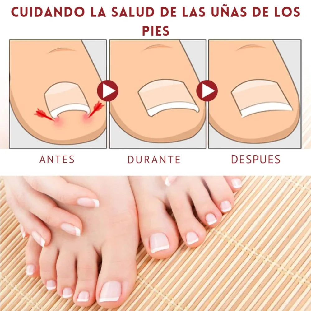 German ToenailPlus: Uñas sanas y brillantes