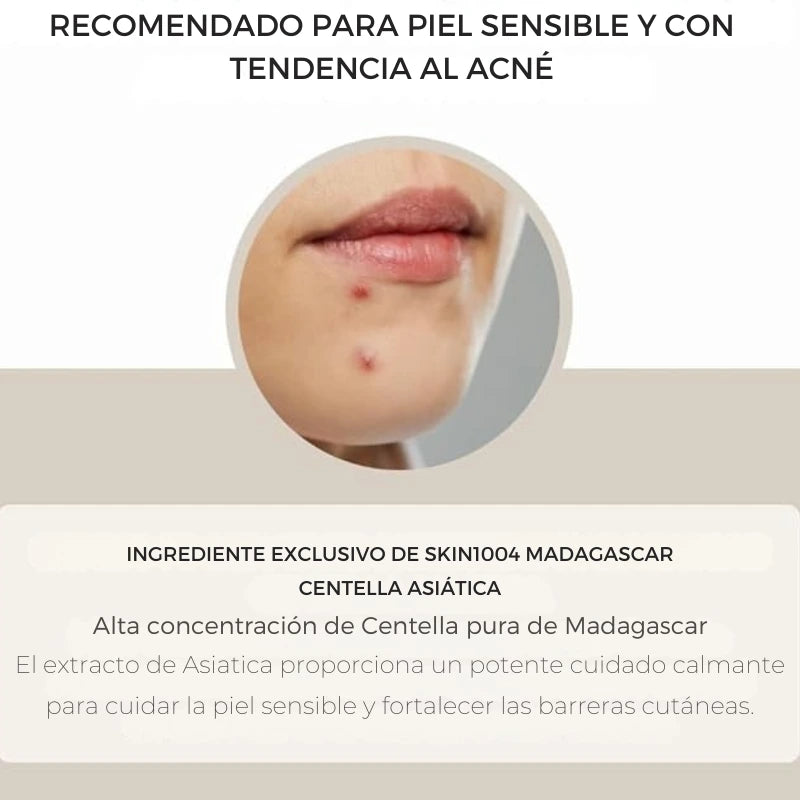 Serum Centella de Madagascar - alivia la piel sensible y propensa al acné