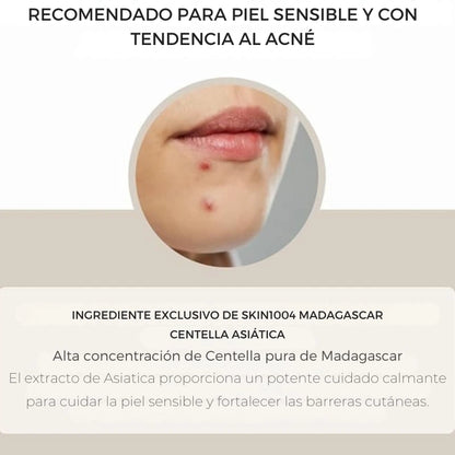 Serum Centella de Madagascar - alivia la piel sensible y propensa al acné
